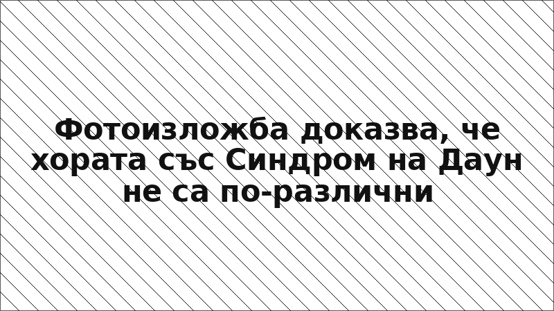 Фотоизложба доказва, че хората със Синдром на Даун не са по-различни